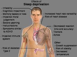 sleep deprivation